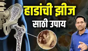 हाडांची झीज भरून काढण्यासाठी घरगुती नैसर्गिक उपाय — दुधात मिसळा 'ही' दोन गोष्टी