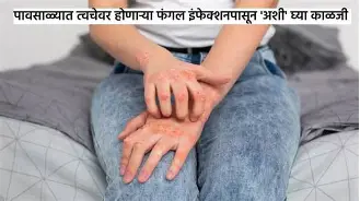 पावसाळ्यात फंगल इन्फेक्शनपासून स्वतःचे संरक्षण कसे करावे? जाणून घ्या महत्त्वाचे उपाय