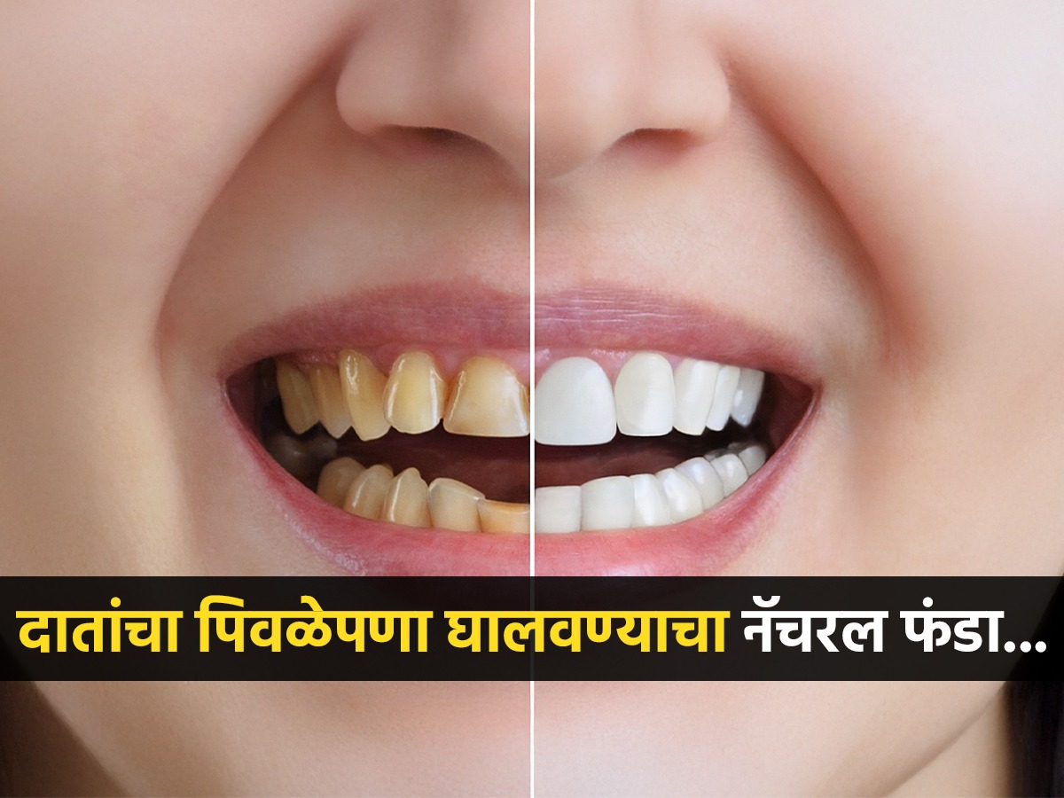 दात चमकदार करण्यासाठी नैसर्गिक उपाय: लवंग आणि तुरटीचा वापर